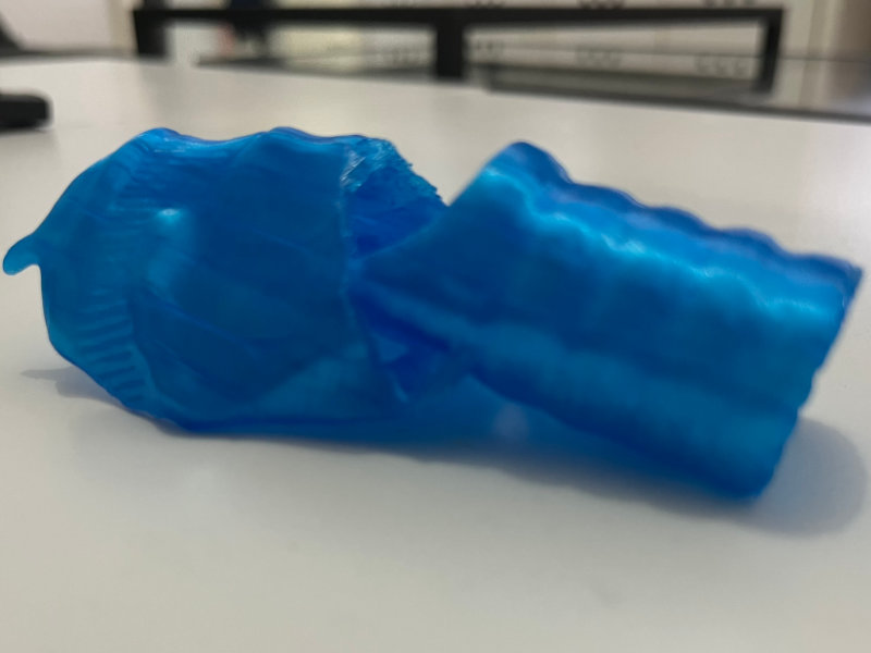 Impression 3D en TPU d'un larynx